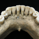 The medieval woman’s teeth.